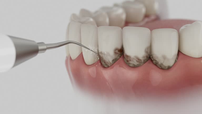 Trusted Emergency Dentist service in Monroe, MI - Dentist Open Now